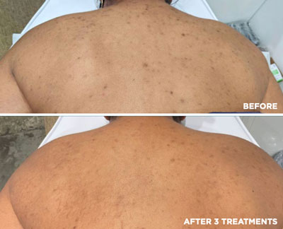 vipeel body soho nyc